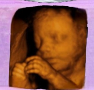 Warm 3D ultrasound image of a baby's face from BabyLoading