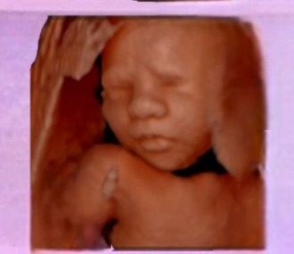 Enhanced 5D ultrasound image of a baby's face from BabyLoading