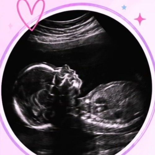 Beautiful black and white 2D ultrasound profile