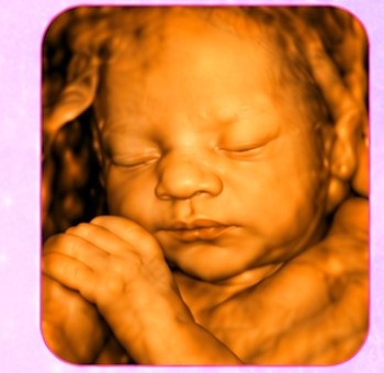Detailed 3D ultrasound image from a Baby Features Peek session