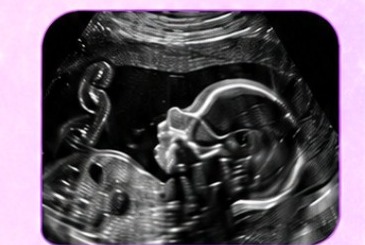 Black and white 2D fetal profile ultrasound from BabyLoading